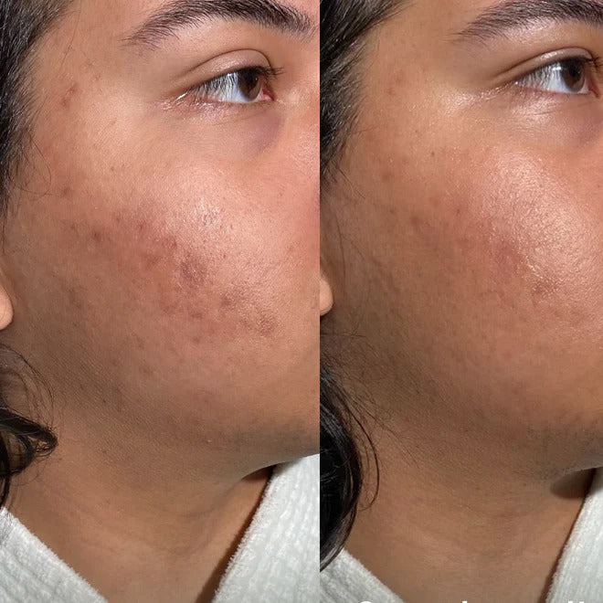 Dr. Zenovia Scar Gel Treatment