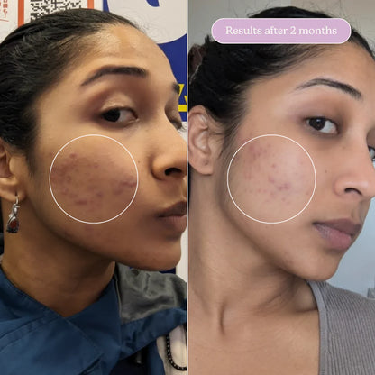 Blume Milky Fade Serum